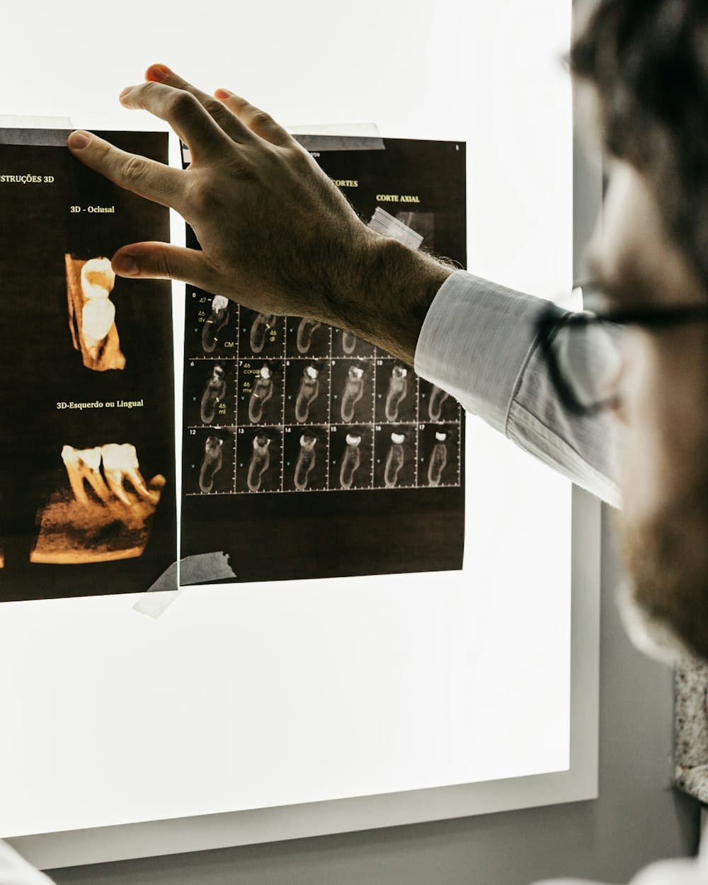 Endodontia — Ortocelos